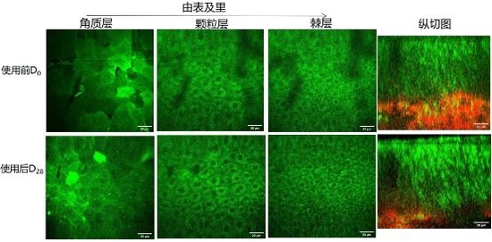 (如薇玻尿酸泛醇盈润精华水使用前后分层皮肤细胞排列图像)