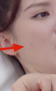 明星都发愁的影响颜值的肌肤问题 你还不重视吗?