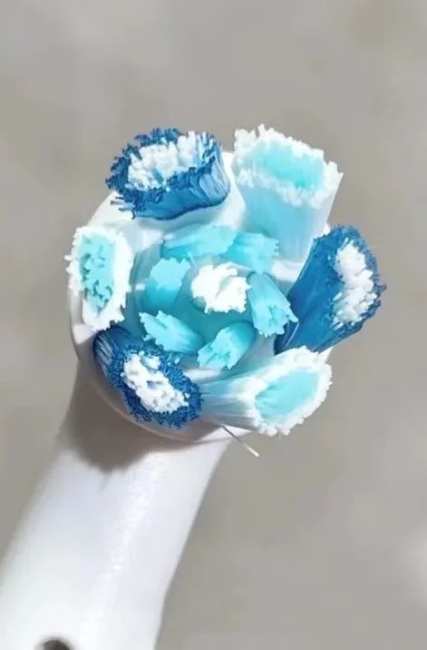 口腔cr什么意思不想“老掉牙”？那这些关键点要从现在抓起啦！_https://www.jmylbn.com_新闻资讯_第32张