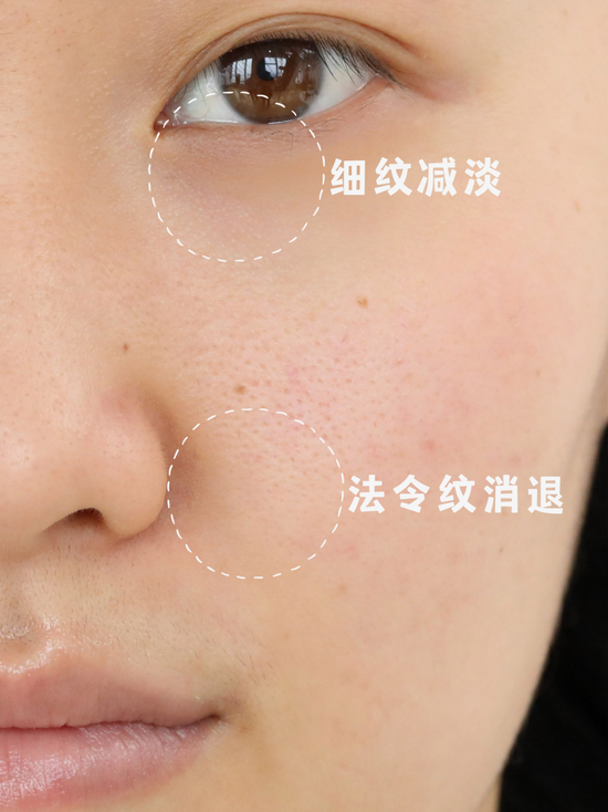 图片制作于Canva,使用效果因人而异