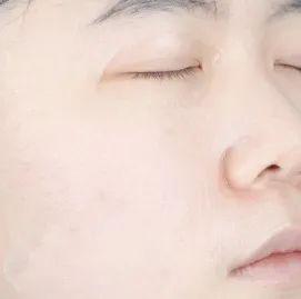 在家不好好护肤?小心这些皮肤问题找上你