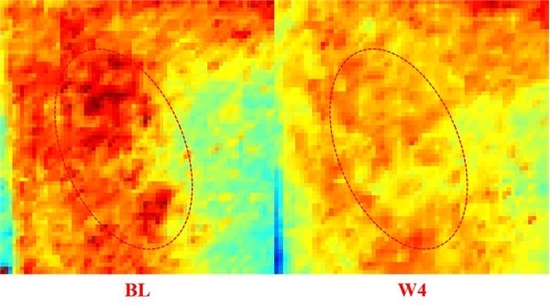 使用如薇玻尿酸泛醇盈润精华乳前后对比示例图

(敏感肌受试者TiVi700采集图像)