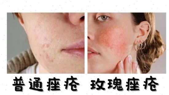图源图虫创意,制作于canva