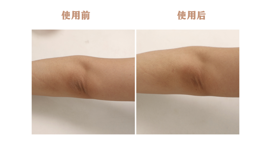 *使用效果因人而异