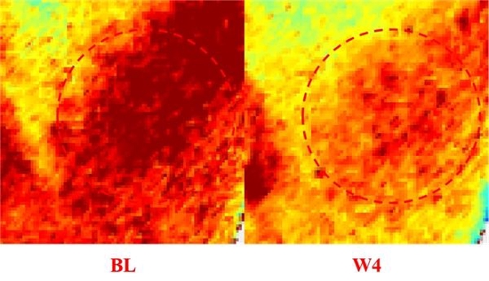 使用如薇玻尿酸泛醇盈润精华水前后对比示例图

(敏感肌受试者TiVi700采集图像)