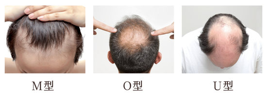图12来源视觉中国,图3来源canva