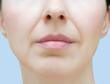 靠修图都救不了的法令纹怎么解