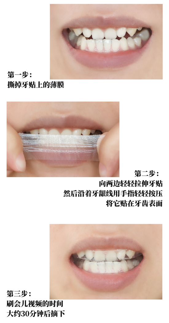 口腔cr什么意思你会注重口腔护理吗？_https://www.jmylbn.com_新闻资讯_第35张