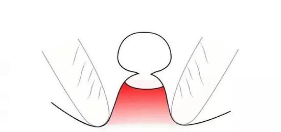 喜欢挤痘痘那对付痘痘的正确手法你知道吗 痘痘 祛痘 护肤 新浪时尚 新浪网