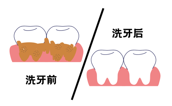 口腔cr什么意思不想“老掉牙”？那这些关键点要从现在抓起啦！_https://www.jmylbn.com_新闻资讯_第20张