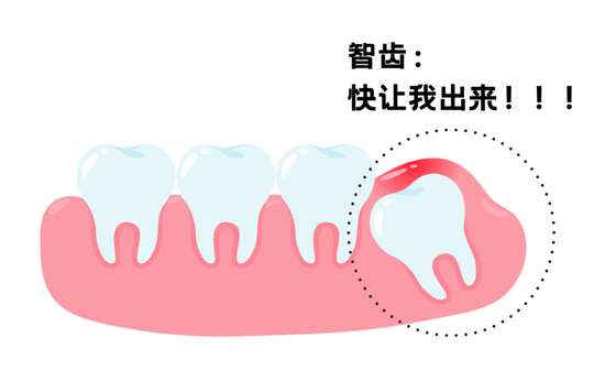 口腔cr什么意思不想“老掉牙”？那这些关键点要从现在抓起啦！_https://www.jmylbn.com_新闻资讯_第23张