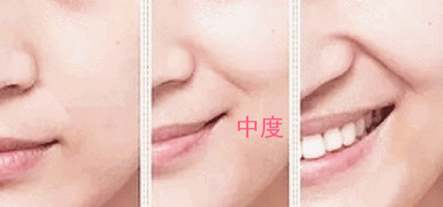 经常做这几个动作轻松拥有小v脸 面部肌肉练习 法令纹 双下巴 新浪时尚 新浪网