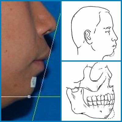 下巴|嘴凸_新浪女性_新浪网