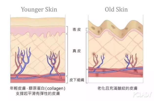 皮肤出现皱纹