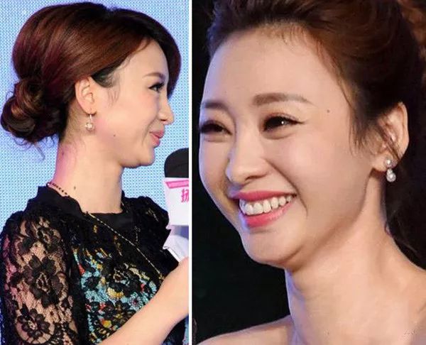 柳岩而且双下巴这个东西可不是瘦子就没有的,那些体重不过百的女明星