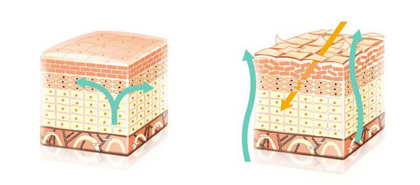 左：健康的皮肤屏障 右：受损的皮肤屏障