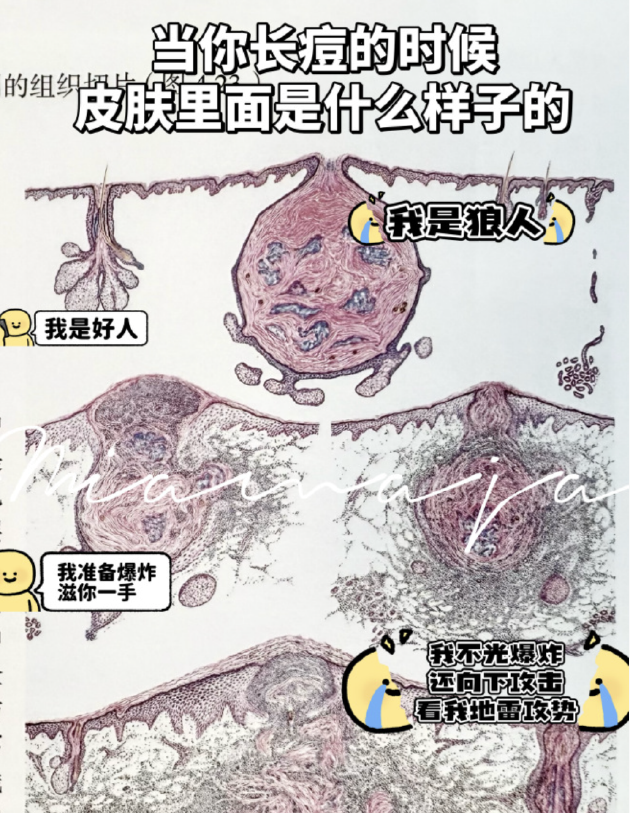 Ƥ��������ӡ�����ӵ�����