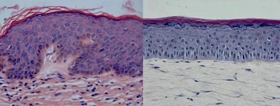 　真人皮肤切片 vs 全层皮肤模型切片