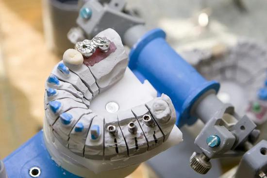 家鸿口腔冲击“假牙第一股” 业务不稳定性一箩筐