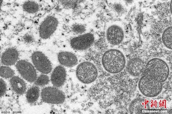 资料图：美国疾病控制和预防中心提供的电子显微镜图像显示，成熟的猴痘病毒（左）和未成熟病毒粒子（右）。