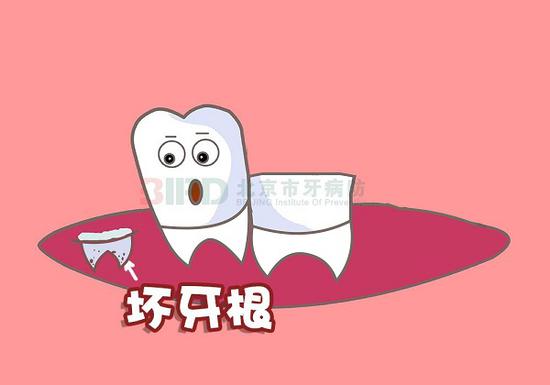 口腔科普：我的牙根将何去何从？