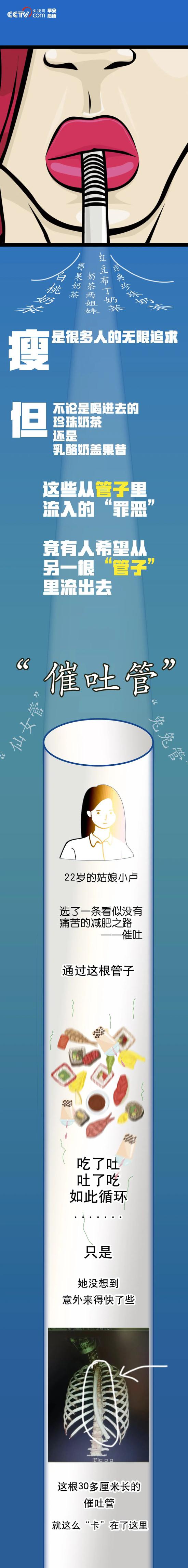 催吐已经形成产业链 医生告诫：可能造成心脏骤停导致死亡