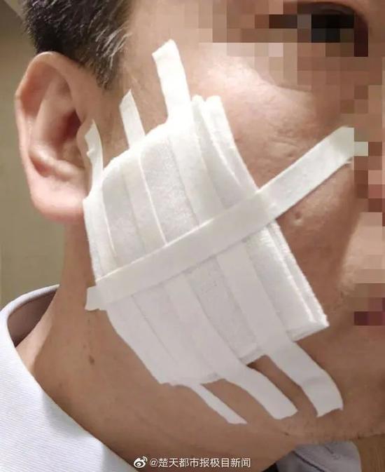 西安一公司高管用烟头烫员工脸被免职 新华社怒批