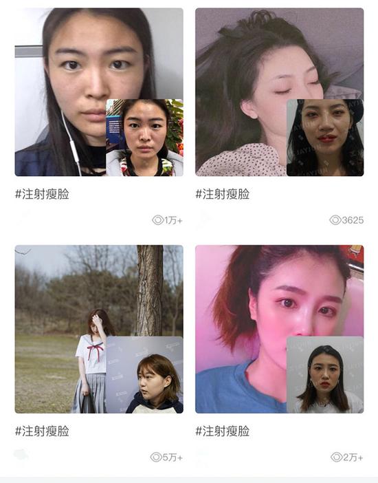 用户整容前后对比图 来源：某整形APP