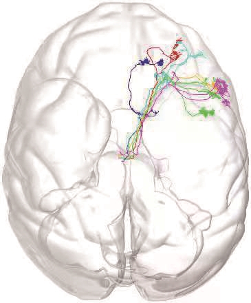 猕猴丘脑神经元群体投射王纳来源:广州日报精度猕猴大脑三维高清成像