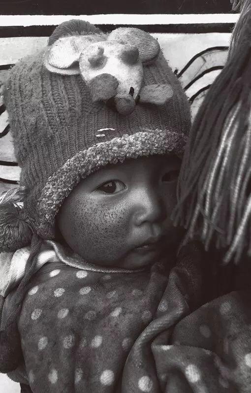 小脸布满皲裂的孩子