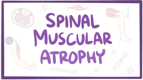  ▲脊髓性肌萎缩症的英文名称Spinal muscular atrophy，又被称为“婴幼儿遗传病杀手”。图据《新医学》杂志