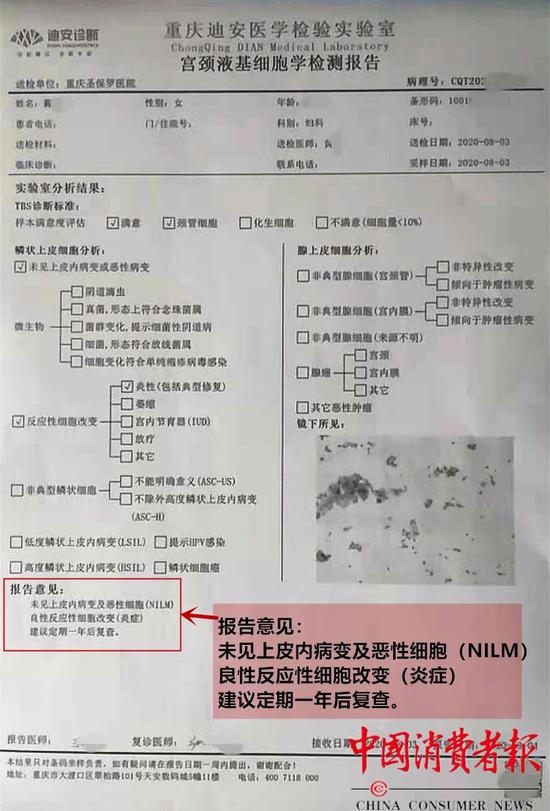 另外,"炎性反应"显示为良性,检测报告只是建议一年后去复查,无需治疗