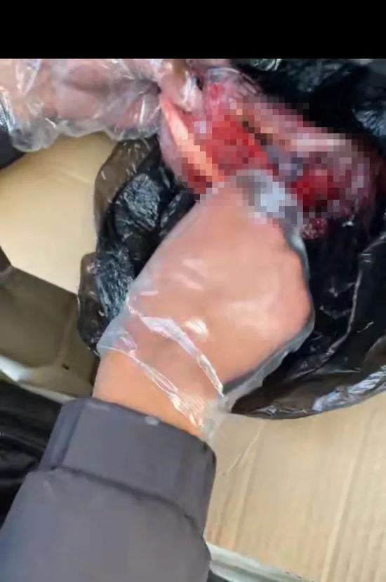 暗访胎盘黑市（内容可能引起不适，但问题很严重）