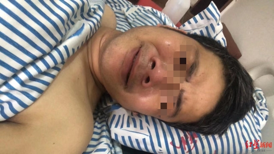 多功能病床控制怎么江西小伙因“百万年薪”被骗到缅甸从事电信诈骗，逃跑时遭殴打至手腿粉碎性骨折_https://www.jmylbn.com_新闻资讯_第1张