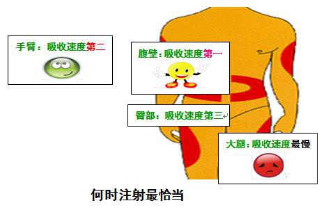 胰岛素注射的“家庭私语”
