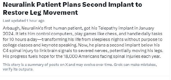 搜狐订阅:一号店礼品卡回收-Neuralink首位受试者计划进行第二次植入，有望恢复腿部活动