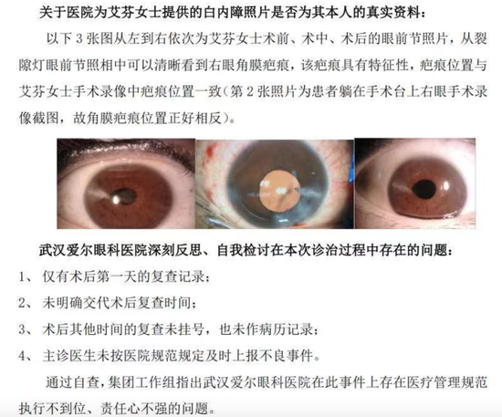 △爱尔眼科针对该事件的核查报告。截图来自：爱尔眼科医院微博