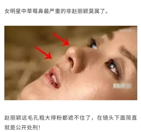 △ 公众号推文中，赵丽颖被指“草莓鼻最严重”