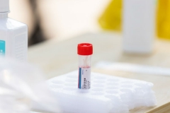 朴石医学核酸检测数据造假？房山区卫健委：有一些问题，停止收样