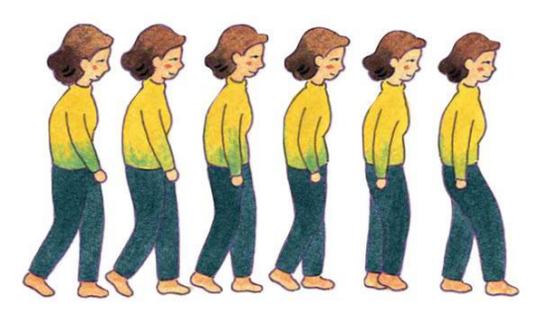走路姿势反映身体情况?这几个姿势隐藏问题不容忽视
