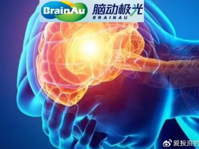 脑机概念股部分走高 脑动极光-B涨逾11%南京熊猫电子股份涨逾6%