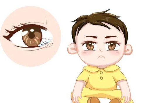 孩子睫毛倒着长流泪刺痛家长一刀剪完后又去医院了