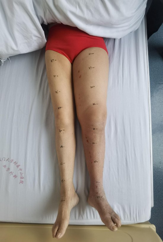 张阿姨入院时的照片