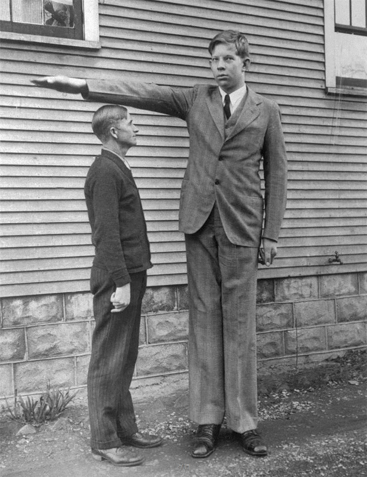 世界上最高的男人,姚明只到他的肩膀,22岁不幸死于败血症