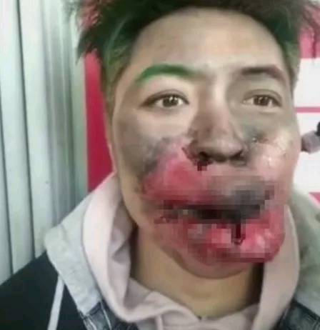 男子街头嘴被打肿路人看到后报警得知真相警察却说活该