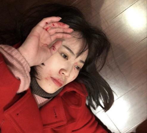 马蓉躺在病床接受采访几小时后慌忙出院,这些细节说明了三个问题