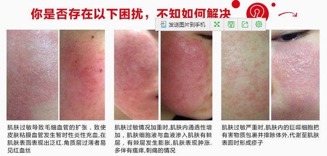 玫玫护肤老师;涂护肤品刺痛是因为皮肤干燥还是屏障受损呢?|屏障|皮肤|受损_新浪新闻