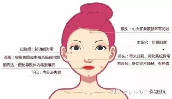 鼓鼓腮帮子两侧总长痘痘,反反复复,该怎么办?|痘痘|护理|肌肤问题_新浪新闻