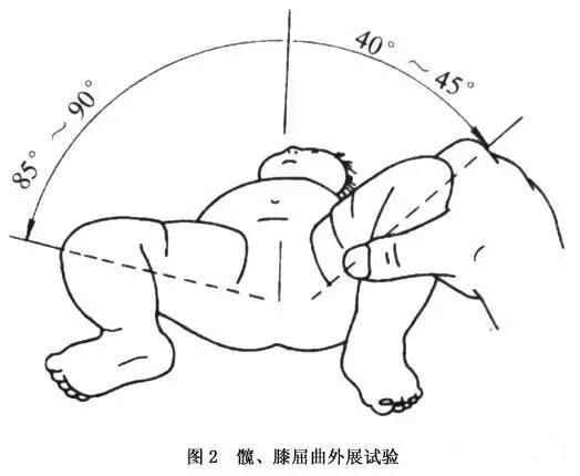 宝宝腿纹不对称需要注意爸妈需要留意的特征必要时要看医生