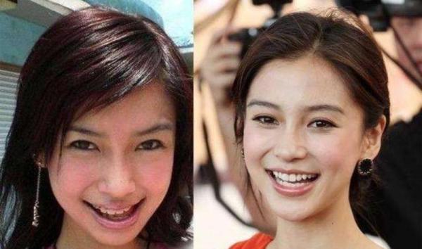 傅园慧整牙堪比整容,看完明星整牙照片后,网友:我相信baby没整